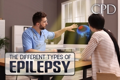 CPD – The Different Types of Epilepsy