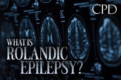 CPD – What is Rolandic Epilepsy?