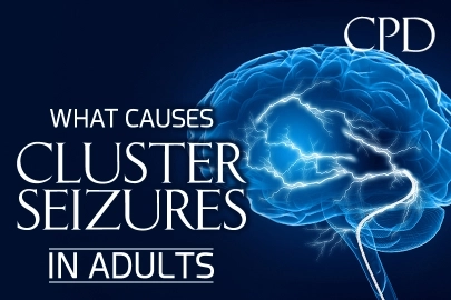 CPD – What Causes Cluster Seizures in Adults