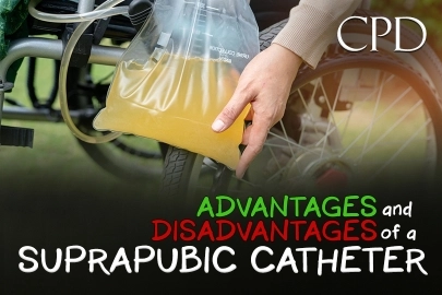 CPD – Advantages and Disadvantages of a Suprapubic Catheter