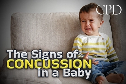 CPD – The Signs of Concussion in a Baby