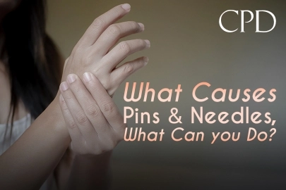 CPD – What Causes Pins and Needles, What Can you Do?