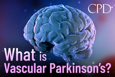 CPD – What is Vascular Parkinson