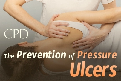 CPD – The Prevention of Pressure Ulcers