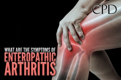 CPD – What are the Symptoms of Enteropathic Arthritis