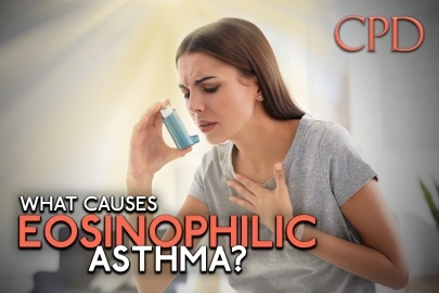 CPD – What Causes Eosinophilic Asthma?