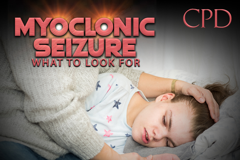 CPD – Myoclonic Seizure: What to Look For